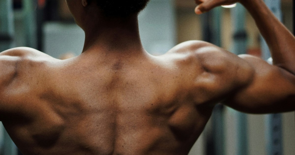 Testosterone propionate: understanding laboratory monitoring